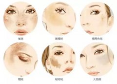 遼寧沈陽(yáng)大連超皮秒價(jià)格，遼寧沈陽(yáng)大連超皮秒廠(chǎng)家，超皮秒祛斑效果怎么樣？