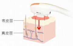 ?牛奶光機器多少錢一臺？?牛奶光價格報價_?牛奶光設備多少錢