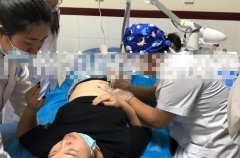 點陣激光設備哪個牌子好？國產點陣激光儀器_co2點陣激光治療儀品牌