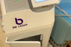 BB laser素顏光國內哪個生產廠家比較好？進口素顏光設備代理商